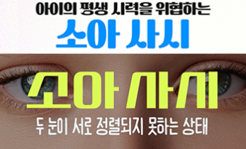 우리 아이의 평생 시력을 위협할 수 있는 ‘소아 사시’